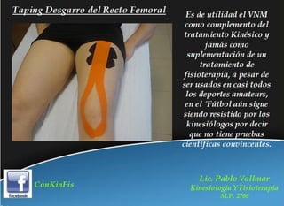 Rehabilitación en Desgarros del Recto Anterior del Muslo