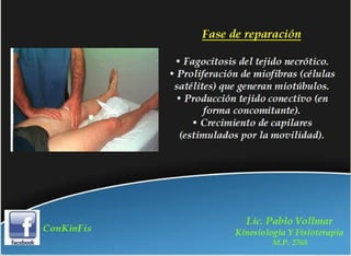 Rehabilitación en Desgarros del Recto Anterior del Muslo