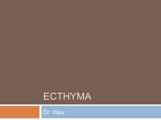 ECTHYMA 
Dr. Vijay 
 