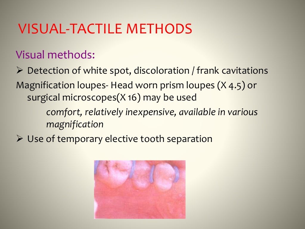 Detection and diagnosis of dental caries