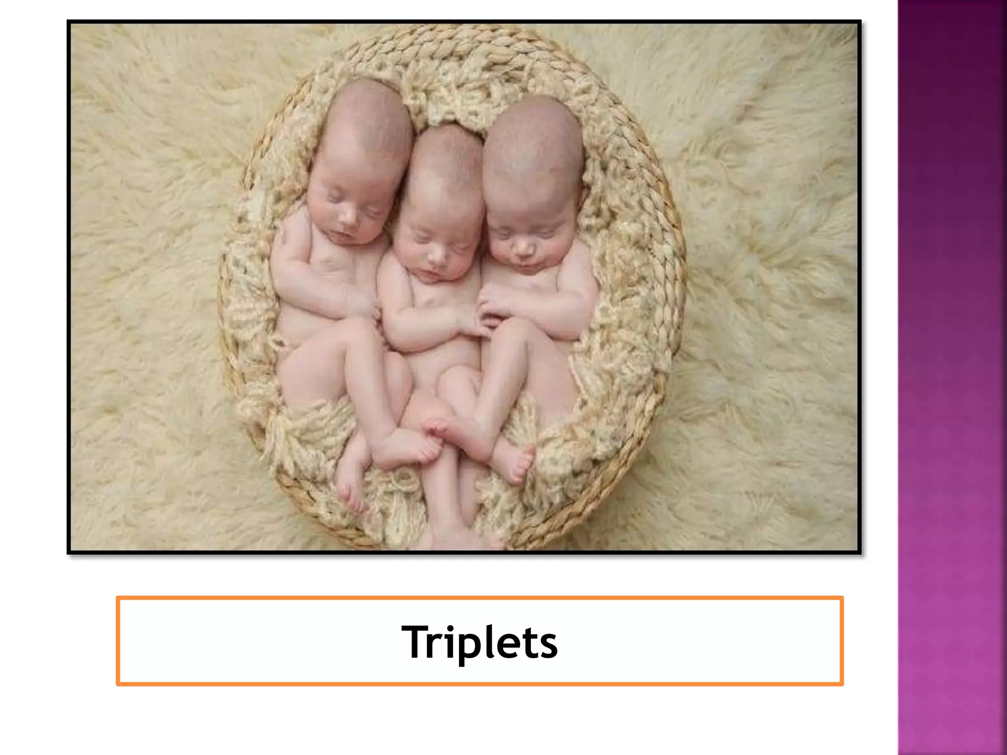 Triplets
 