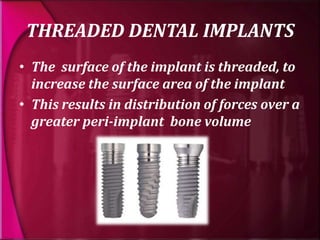 types and classification of dental implants