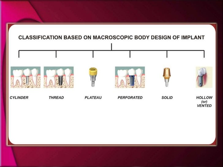 types of dental implants