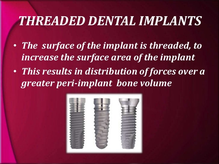 types and classification of dental implants