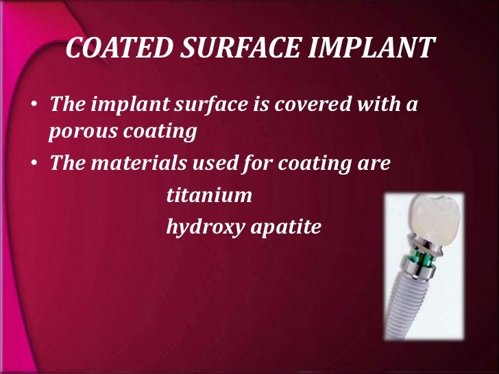 types and classification of dental implants