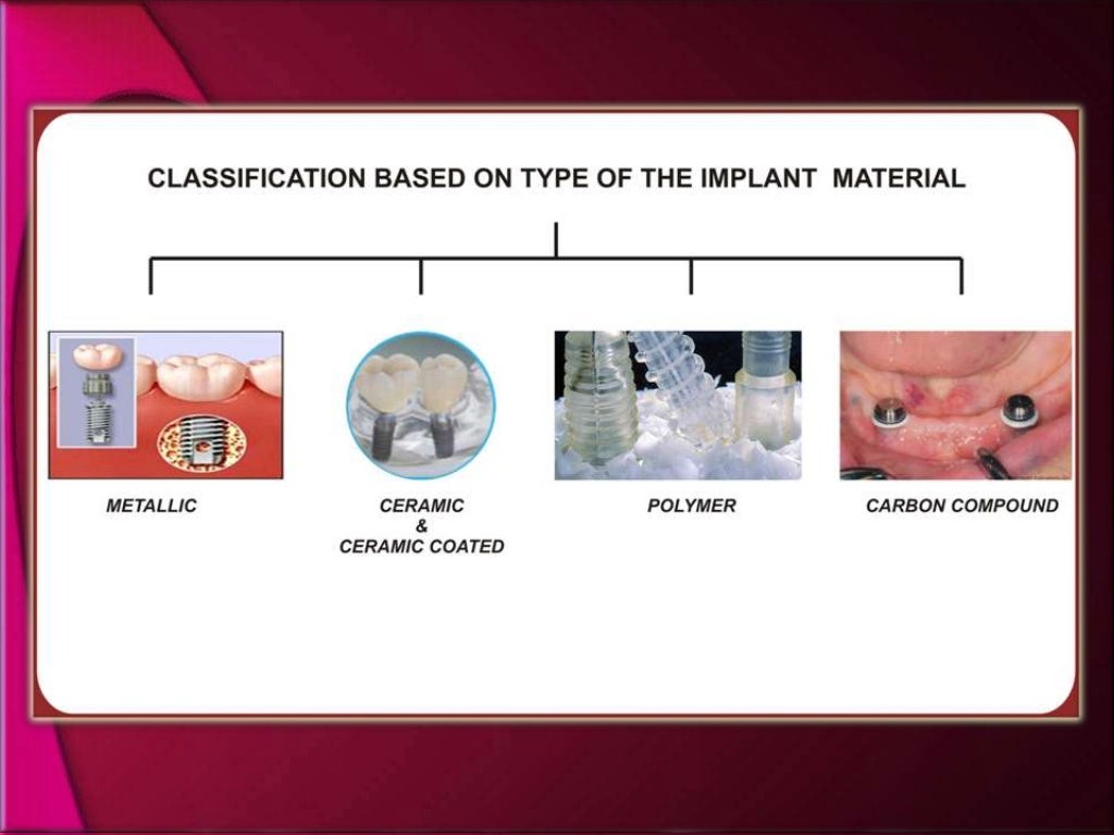 types and classification of dental implants