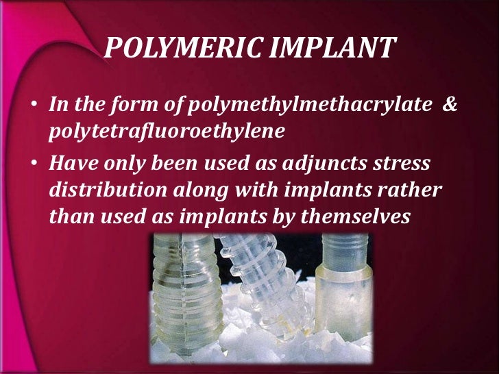 types and classification of dental implants