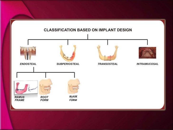 types and classification of dental implants endosteal implant