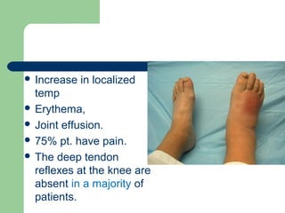  Increase in localized
temp
 Erythema,
 Joint effusion.
 75% pt. have pain.
 The deep tendon
reflexes at the knee are
absent in a majority of
patients.
 