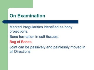 On Examination
Marked Irregularities identified as bony
projections.
Bone formation in soft tissues.
Bag of Bones:
Joint can be passively and painlessly moved in
all Directions
 
