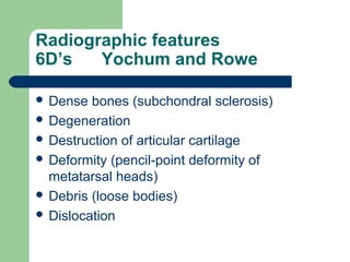 Radiographic features
6D’s Yochum and Rowe
 Dense bones (subchondral sclerosis)
 Degeneration
 Destruction of articular cartilage
 Deformity (pencil-point deformity of
metatarsal heads)
 Debris (loose bodies)
 Dislocation
 