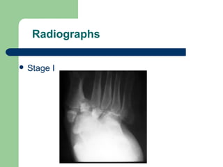 Radiographs
 Stage I
 