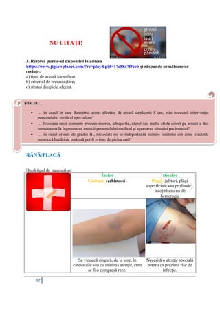 32
NU UITAȚI!
3. Rezolvă puzzle-ul disponibil la adresa
https://www.jigsawplanet.com/?rc=play&pid=17e58a7f3ceb și răspunde următoarelor
cerințe:
a) tipul de arsură identificat;
b) criteriul de recunoaștere;
c) stratul din piele afectat.
RĂNĂ/PLAGĂ
După tipul de traumatism:
Închis Deschis
Contuzie (echimoză) Plagă (julituri, plăgi
superficiale sau profunde),
însoțită sau nu de
hemoragie
Se vindecă singură, de la sine, în
câteva zile sau cu minimă atenție, cum
ar fi o compresă rece.
Necesită o atenție specială
pentru că prezintă risc de
infecție.
Știai că…
 … în cazul în care diametrul zonei afectate de arsură depășește 8 cm, este necesară intervenția
personalului medical specializat?
 … folosirea unor alimente precum mierea, albușurile, uleiul sau multe altele direct pe arsură a dus
întotdeauna la îngreunarea muncii personalului medical și agravarea situației pacientului?
 … în cazul arsurii de gradul III, niciodată nu se îndepărtează hainele rănitului din zona afectată,
pentru că bucăți de țesătură pot fi prinse de pielea arsă?
 