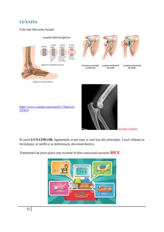 35
LUXAȚIA
Cele mai frecvente luxații:
https://www.youtube.com/watch?v=OmCuA-
ZY9C4
luxația cotului
În cazul LUXAȚIILOR, ligamentele se pot rupe și osul iese din articulație. Locul vătămat se
învinețește, se umflă și se deformează, devenind dureros.
Tratamentul de prim ajutor este rezumat în bine cunoscutul acronim RICE :
 