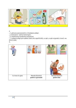 39
4 6 5
4.
_3_aplicarea pansamentelor și bandajarea plăgii;
_2_hemostaza / oprirea hemoragiei;
_4_imobilizarea membrului traumatizat;
_1_curățarea plăgii prin spălare (dacă este superficială), cu apă, cu apă oxigenată, rivanol, sau
alcool iodat;
5.
Lovitura în spate Metoda Heimlich
pentru o persoană
Metoda Heimlich
pentru tine
 