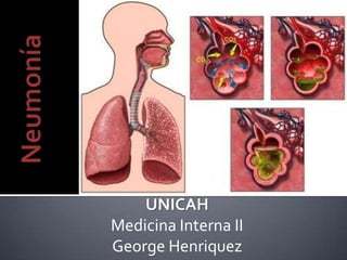 UNICAH
Medicina Interna II
George Henriquez
 