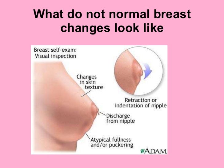 Normal Breast Texture 62