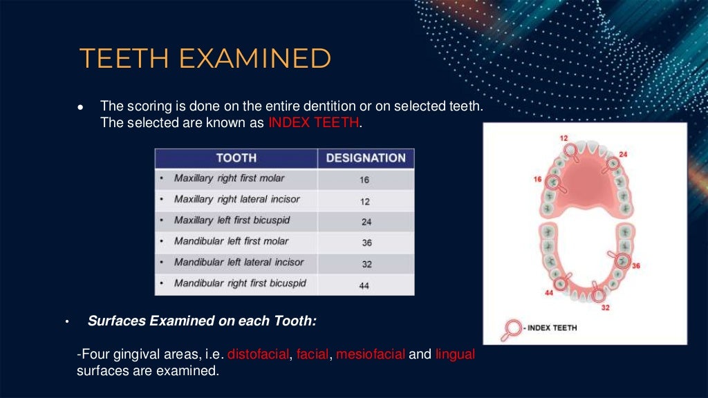 Gingival Index (By Loes and Sillness)