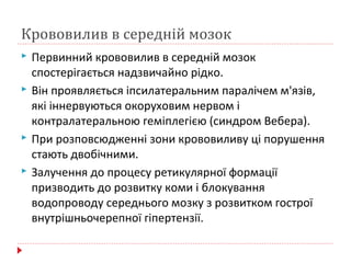 Крововилив в середній мозок
 Первинний крововилив в середній мозок
спостерігається надзвичайно рідко.
 Він проявляється іпсилатеральним паралічем м'язів,
які іннервуються окоруховим нервом і
контралатеральною геміплегією (синдром Вебера).
 При розповсюдженні зони крововиливу ці порушення
стають двобічними.
 Залучення до процесу ретикулярної формації
призводить до розвитку коми і блокування
водопроводу середнього мозку з розвитком гострої
внутрішньочерепної гіпертензії.
 
