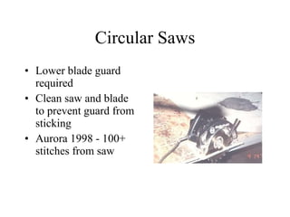 Circular Saws Lower blade guard required Clean saw and blade to prevent guard from sticking Aurora 1998 - 100+ stitches from saw 