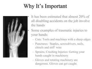 Why It’s Important 
• It has been estimated that almost 20% of 
all disabling accidents on the job involve 
the hands 
• Some examples of traumatic injuries to 
your hands: 
– Cuts: Tools and machines with a sharp edges 
– Punctures: Staples, screwdrivers, nails, 
chisels and stiff wire 
– Sprains, Crushing Injuries: Getting your 
hands caught in machinery 
– Gloves and rotating machinery are 
dangerous. Gloves can get caught. 
 