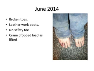 June 2014
• Broken toes.
• Leather work boots.
• No safety toe
• Crane dropped load as
lifted
 