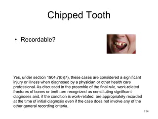 Chipped Tooth
• Recordable?
114
Yes, under section 1904.7(b)(7), these cases are considered a significant
injury or illness when diagnosed by a physician or other health care
professional. As discussed in the preamble of the final rule, work-related
fractures of bones or teeth are recognized as constituting significant
diagnoses and, if the condition is work-related, are appropriately recorded
at the time of initial diagnosis even if the case does not involve any of the
other general recording criteria.
 