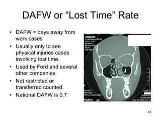 DAFW or “Lost Time” Rate
• DAFW = days away from
work cases
• Usually only to see
physical injuries cases
involving lost time.
• Used by Ford and several
other companies.
• Not restricted or
transferred counted.
• National DAFW is 0.7
45
 