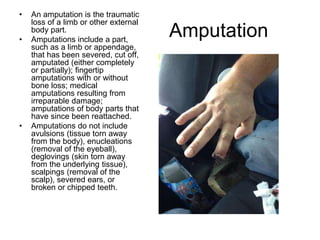 Amputation
• An amputation is the traumatic
loss of a limb or other external
body part.
• Amputations include a part,
such as a limb or appendage,
that has been severed, cut off,
amputated (either completely
or partially); fingertip
amputations with or without
bone loss; medical
amputations resulting from
irreparable damage;
amputations of body parts that
have since been reattached.
• Amputations do not include
avulsions (tissue torn away
from the body), enucleations
(removal of the eyeball),
deglovings (skin torn away
from the underlying tissue),
scalpings (removal of the
scalp), severed ears, or
broken or chipped teeth.
 