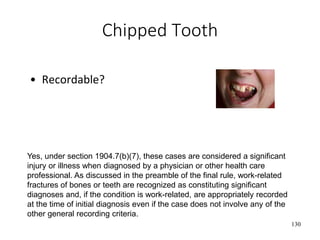 Chipped Tooth
• Recordable?
130
Yes, under section 1904.7(b)(7), these cases are considered a significant
injury or illness when diagnosed by a physician or other health care
professional. As discussed in the preamble of the final rule, work-related
fractures of bones or teeth are recognized as constituting significant
diagnoses and, if the condition is work-related, are appropriately recorded
at the time of initial diagnosis even if the case does not involve any of the
other general recording criteria.
 