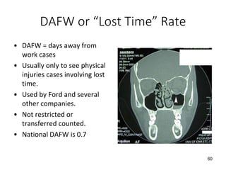 DAFW or “Lost Time” Rate
• DAFW = days away from
work cases
• Usually only to see physical
injuries cases involving lost
time.
• Used by Ford and several
other companies.
• Not restricted or
transferred counted.
• National DAFW is 0.7
60
 