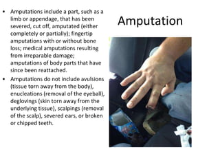 Amputation
• Amputations include a part, such as a
limb or appendage, that has been
severed, cut off, amputated (either
completely or partially); fingertip
amputations with or without bone
loss; medical amputations resulting
from irreparable damage;
amputations of body parts that have
since been reattached.
• Amputations do not include avulsions
(tissue torn away from the body),
enucleations (removal of the eyeball),
deglovings (skin torn away from the
underlying tissue), scalpings (removal
of the scalp), severed ears, or broken
or chipped teeth.
 