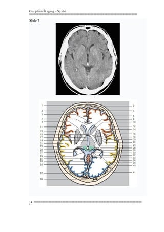 Giải phẫu cắt ngang – Sọ não
|||||||||||||||||||||||||||||||||||||||||||||||||||||||||||||||||||||||||||||||||||||||||||||||||||||||||||||||||||||||||||||||||||||||||||||||||||||||||||||||||||||||||||||||||||||||||||||||||||||||||||||||||||||||||||||||||||||||||||||||||||||||||||||||||||||
||||||||||||||||||||||||||||||||||||||||||||||||||||||||||||||||||||||||||||||||||||||||||||||||||||||||||||||||||||||||||||||||||||||||||||||||||||||||||||||||||||||||||||||||||||||||||||||||||||||||||||||||||||||||||||||||||||||||||||||||||||||||||||||||||||
|
14
Slide 7
 