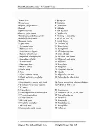 Atlas of Sectional Anatomy – Cranial CT Axial
|||||||||||||||||||||||||||||||||||||||||||||||||||||||||||||||||||||||||||||||||||||||||||||||||||||||||||||||||||||||||||||||||||||||||||||||||||||||||||||||||||||||||||||||||||||||||||||||||||||||||||||||||||||||||||||||||||||||||||||||||||||||||||||||||||||
||||||||||||||||||||||||||||||||||||||||||||||||||||||||||||||||||||||||||||||||||||||||||||||||||||||||||||||||||||||||||||||||||||||||||||||||||||||||||||||||||||||||||||||||||||||||||||||||||||||||||||||||||||||||||||||||||||||||||||||||||||||||||||||||||||
|
Giải phẫu hình ảnh cắt lớp điện toán. Chú giải: Nguyễn Hữu Ánh
7
7
1 Frontal bone
2 Frontal sinus
3 Superior oblique muscle
4 Eyeball
5 Ophthalmic vein
6 Superior rectus muscle
7 Straight gyrus and olfactory bulb
8 Retro-orbital fatty tissue
9 Temporal muscle
10 Optic nerve
11 Sphenoidal sinus
12 Sphenoidal bone
13 Inferior temporal gyrus
14 Superior orbital fissure
15 Trigeminal nerve (ganglion)
16 Internal carotid artery
17 Pontinecistern
18 Cavernous sinus
19 Mastoid antrum
20 Basilar artery
21 Pons
22 Ponto cerebellar cistern
23 Middle and inferior cerebellar
peduncle
24 Internal auditory meatus with facial
(VII) and vestibulocochlear /acoustic
(VIII) nerves
25. Sigmoid sinus
26. Mastoid process with mastoid cells
27. Vermis of cerebellum
28. Fourth ventricle
29. Occipital sinus
30. Cerebellar hemisphere
31. Occipital bone
32. Semispinalis capitis muscle
1. Xương trán
2. Xoang trán
3. Cơ chéo trên
4. Nhãn cầu
5. Tĩnh mạch mắt
6. Cơ thẳng trên
7. Hồi thẳng và hành khứu
8. Mô mỡ sau nhãn cầu
9. Cơ thái dương
10. Thần kinh thị
11. Xoang bướm
12. Xương bướm
13. Hồi thái dương dưới
14. Khe ổ mắt trên
15. Hạch thần kinh sinh ba
16. Động mạch cảnh trong
17. Bể cầu não
18. Xoang hang
19. Hang chũm
20. Động mạch thân nền
21. Cầu não
22. Bể góc cầu - tiểu não
23. Cuống tiểu não giữa và dưới
24. Ống tai trong với các cấu trúc thần kinh
mặt VII và tiền đình ốc tai
25. Xoang sigma
26. Mỏm chũm với các khí bào chũm
27. Thùy nhộng tiểu não
28. Não thất tư
29. Xoang chẩm
30. Bán cầu tiểu não
31. Xương chẩm
32. Cơ bán gai
 