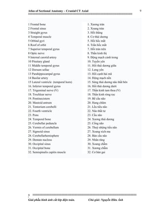 Atlas of Sectional Anatomy – Cranial CT Axial
|||||||||||||||||||||||||||||||||||||||||||||||||||||||||||||||||||||||||||||||||||||||||||||||||||||||||||||||||||||||||||||||||||||||||||||||||||||||||||||||||||||||||||||||||||||||||||||||||||||||||||||||||||||||||||||||||||||||||||||||||||||||||||||||||||||
||||||||||||||||||||||||||||||||||||||||||||||||||||||||||||||||||||||||||||||||||||||||||||||||||||||||||||||||||||||||||||||||||||||||||||||||||||||||||||||||||||||||||||||||||||||||||||||||||||||||||||||||||||||||||||||||||||||||||||||||||||||||||||||||||||
|
Giải phẫu hình ảnh cắt lớp điện toán. Chú giải: Nguyễn Hữu Ánh
9
9
1 Frontal bone
2 Frontal sinus
3 Straight gyrus
4 Temporal muscle
5 Orbital gyri
6 Roof of orbit
7 Superior temporal gyrus
8 Optic nerve
9 Internal carotid artery
10 Pituitary gland
11 Middle temporal gyrus
12 Dorsum sellae
13 Parahippocampal gyrus
14 Basilar artery
15 Lateral ventricle (temporal horn)
16. Inferior temporal gyrus
17. Trigeminal nerve (V)
18. Trochlear nerve
19. Pontinecistern
20. Mastoid antrum
21. Tentorium cerebelli
22. Fourth ventricle
23. Pons
24. Temporal bone
25. Cerebellar peduncle
26. Vermis of cerebellum
27. Sigmoid sinus
28. Cerebellarhemisphere
29. Dentate nucleus
30. Occipital sinus
31. Occipital bone
32. Semispinalis capitis muscle
1. Xương trán
2. Xoang trán
3. Hồi thẳng
4. Cơ thái dương
5. Hồi hốc mắt
6. Trần hốc mắt
7. Hồi trán trên
8. Thần kinh thị
9. Động mạch cảnh trong
10. Tuyến yên
11. Hồi thái dương giữa
12. Lưng yên
13. Hồi cạnh hải mã
14. Động mạch nền
15. Sừng thái dương não thất bên
16. Hồi thái dương dưới
17. Thần kinh tam thoa (V)
18. Thần kinh ròng rọc
19. Bể cầu não
20. Hang chũm
21. Lều tiểu não
22. Não thất tư
23. Cầu não
24. Xương thái dương
25. Cống não
26. Thuỳ nhộng tiểu não
27. Xoang xích ma
28. Bán cầu não
29. Nhân răng
30. Xoang chẫm
31. Xương chẫm
32. Cơ bán gai
 