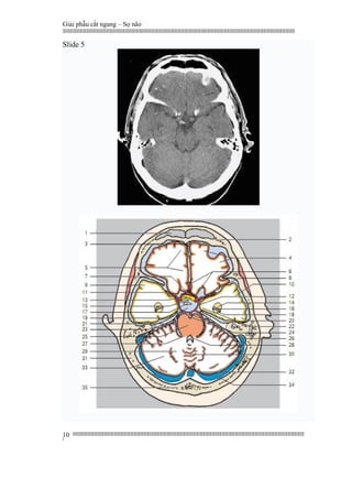Giải phẫu cắt ngang – Sọ não
|||||||||||||||||||||||||||||||||||||||||||||||||||||||||||||||||||||||||||||||||||||||||||||||||||||||||||||||||||||||||||||||||||||||||||||||||||||||||||||||||||||||||||||||||||||||||||||||||||||||||||||||||||||||||||||||||||||||||||||||||||||||||||||||||||||
||||||||||||||||||||||||||||||||||||||||||||||||||||||||||||||||||||||||||||||||||||||||||||||||||||||||||||||||||||||||||||||||||||||||||||||||||||||||||||||||||||||||||||||||||||||||||||||||||||||||||||||||||||||||||||||||||||||||||||||||||||||||||||||||||||
|
10
Slide 5
 