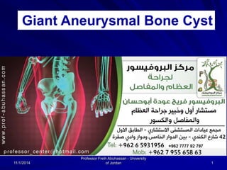 Giant Aneurysmal Bone Cyst 
11/1/2014 
Professor Freih Abuhassan - University 
of Jordan 1 
 