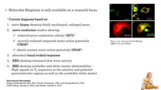  Molecular Diagnosis is only available on a research basis.
•Current diagnosis based on:
1. nerve biopsy showing thinly myelinated, enlarged axons
2. nerve conduction studies showing
 reduced nerve conduction velocity (NCV)
 severely reduced compound motor action potentials
(CMAP)
 absent sensory nerve action potentials (SNAP)
3. abnormal visual evoked responses
4. EEG showing increased slow wave activity
5. MRI showing cerebellar and white matter abnormalities :
High signals on T2 sequences in the anterior and posterior
periventricular regions as well as the cerebellar white matter
Ding, et al. Journal of Cell Biology
158(3):427-433 (2002).
Giant Axonal Neuropathy
Gregor Kuhlenbäumer, MD, PhD, Vincent Timmerman, PhD, and Pascale Bomont, PhD.
Initial Posting: January 9, 2003; Last Update: October 9, 2014.
 