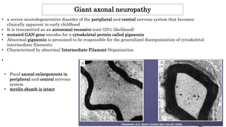 Giant axonal neuropathy
• a severe neurodegenerative disorder of the peripheral and central nervous system that becomes
clinically apparent in early childhood
• It is transmitted as an autosomal recessive trait (25% likelihood)
• mutated GAN gene encodes for a cytoskeletal protein called gigaxonin
• Abnormal gigaxonin is presumed to be responsible for the generalized disorganization of cytoskeletal
intermediate filaments
• Characterized by abnormal Intermediate Filament Organization
•
• Focal axonal enlargements in
peripheral and central nervous
system
• myelin sheath is intact
 