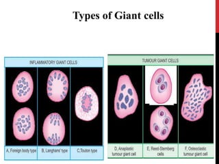 Giant cell lesion.pptx