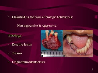 Giant cell lesions of the jaws | PPTX