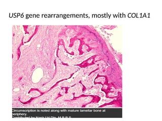 Usp6 Rearrangement Fish giant cell lesions bone.pptx for patholgy pgs | PPTX