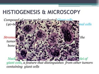 HISTIOGENESIS & MICROSCOPY 
Composed of many multi-nucleated Giant cells 
(40-60 nuclei/cell) in a sea of mono-nuclear stromal cells 
Stromal cells are the main neoplastic component of the 
tumor which regulate giant cell mediated 
bone destruction. 
Nuclei of stromal cells are identical to that of nuclei of 
giant cells, a feature that distinguishes from other tumors 
containing giant cells 
 