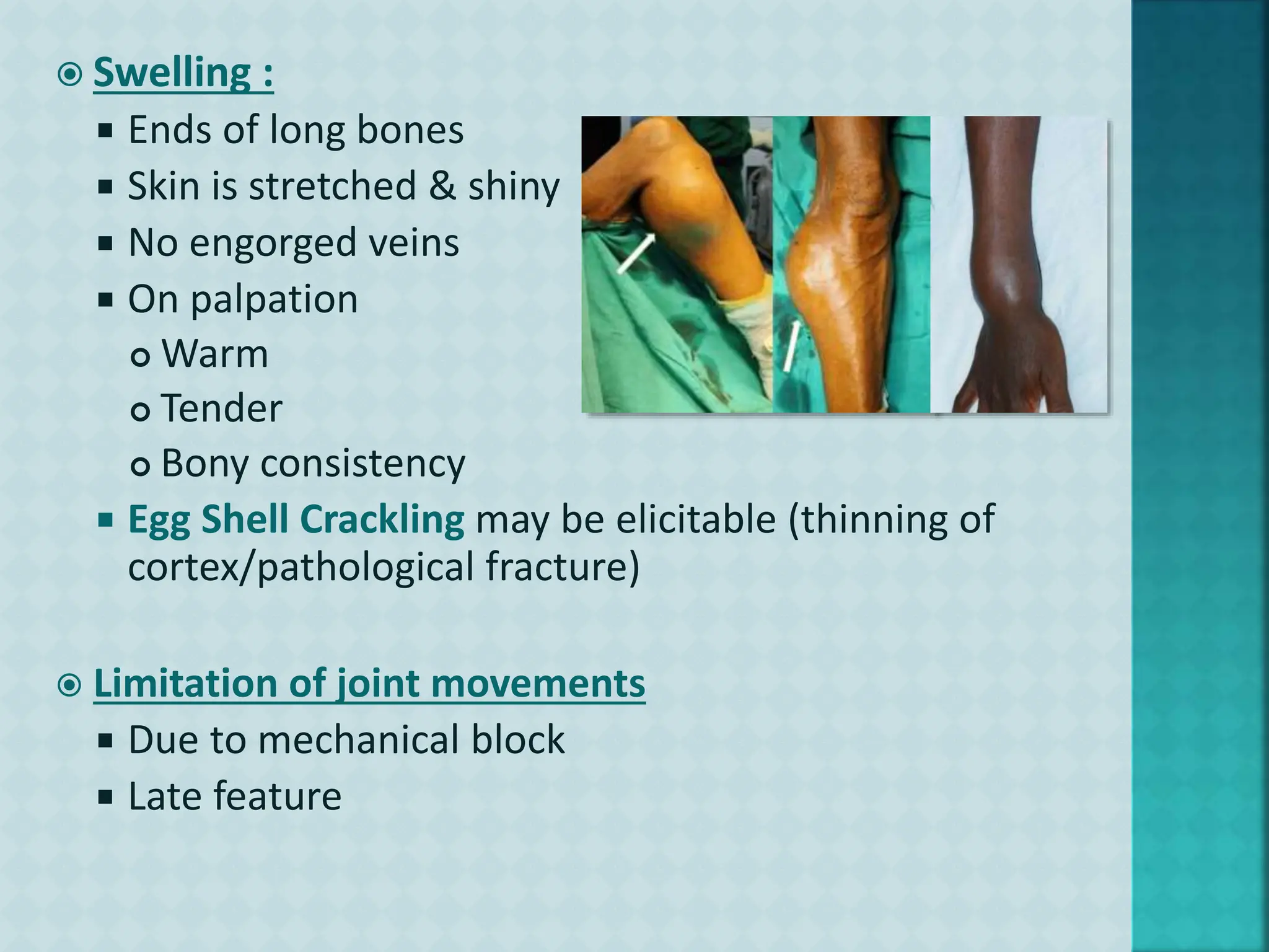 GIANT CELL TUMOR.pptx