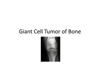 Giant Cell Tumor of Bone
 