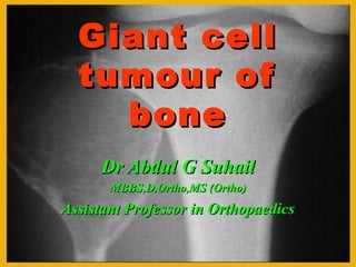 Giant cell
tumour of
bone
Dr Abdul G Suhail
MBBS,D.Ortho,MS (Ortho)

Assistant Professor in Orthopaedics

 