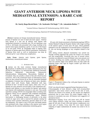International Journal of Scientific and Research Publications, Volume 3, Issue 8, August 2013 1
ISSN 2250-3153
www.ijsrp.org
GIANT ANTERIOR NECK LIPOMA WITH
MEDIASTINAL EXTENSION: A RARE CASE
REPORT
Dr. Smrity Rupa Borah Dutta *, Dr. Sachender Pal Singh **, Dr. Aakanksha Rathor **
*
Assistant Professor, Department OF Otorhinolaryngology, SMCH, Silchar
**
PGT Otorhinolaryngology, Department OF Otorhinolaryngology, SMCH, Silchar
Abstract- Lipomas are benign mesenchymal tumour. Thirteen
percent of lipomas are seen in head and neck region1
. Anterior
neck lipoma is a rare one & anterior neck lipoma with
mediastinal extension is extremely rare. We are reporting a case
of 48 yr. old female who presented with a huge swelling in the
anterior neck region simulating a goitre. It was one of the largest
of its own kind. FNAC & sonography helps in making early
diagnosis of lipoma apart from clinical examination. Enucleation
of lipoma from neck as well as mediastinum was done &
followed up for 1 year without any complication.
Index Terms- Anterior neck Lipoma, giant lipoma,
mediastinum, mesenchymal tumour
I. INTRODUCTION
ipomas are the most common benign mesenchymal
neoplasm of adulthood & are usually subcutaneous but may
develop in other places, e.g. Intermuscular, Subfascial, Parosteal,
Subserous, Submucous, Intra-articular, Subsynovial,
Subendocardium, Subepicardiac, Myocardium, Subdural or
Extradural. They are actually a cluster of fat cells which become
overactive. This is the commonest tumor of subcutaneous tissue.
They are skin colored lesions & are firm & somewhat lobulated
on palpation. Common sites of lipoma are back, arms, shoulder,
anterior chest wall, breasts, thighs, abdominal wall, legs,
forehead & face2
. In head & neck region, where only 13% of
lipomas are seen, posterior cervical space is the commonest site3
.
Anterior neck lipoma is a rare location for lipoma4
and anterior
neck lipoma with mediastinal extension is very rare. Fine needle
aspiration cytology (FNAC) & sonography helps in making early
diagnosis which can be supported with computed tomography
(CT) & confirmed with histopathology report. Surgical
intervention is challenging because of proximity to the great
vessels & vagus nerve and is reserved for patients coming for
cosmesis (most common indication), pressure effects & to rule
out malignancy. We report a case of 48 years old female patient
who presented with a huge swelling in the anterior neck region
extending into the anterior mediastinum mimicking goitre.
II. CASE REPORT
48 years old, female presented in Otorhinolaryngology OPD in
Silchar Medical College & Hospital, Silchar with a huge swelling
in the anterior aspect of neck since 20 years, which gradually
enlarged in size & complained of occasional history of dyspnoea.
Pt. was not having dysphagia or any complain related to her
voice.
After taking consent, physical examination was carried out.
Though swelling appeared like goiter but found to be smooth,
soft and compressible. Overlying skin was of normal colour,
stretched, not adhered to tumor & dilated veins were present over
the tumor. Swelling was mobile, nontender. The surface of the
mass was smooth. Edges were definite above & slips under the
palpating finger (slip sign) & fingers couldn’t get below the
lower margin.
Figure 1: Preoperative photo of pt. with giant lipoma in anterior
aspect & left side of neck.
FNAC was done & report suggested benign lipomatous lesion.
Ultrasonography of neck showed a large well circumscribed
hypoechoic mass lesion noted in front & left side of neck.
Thyroid was found to be normal. & left carotid was displaced
posteriorly due to mass lesion. On colour Doppler study, no
increase in vascularity was seen. All features were suggestive of
lipomatous lesion.
Radiological imaging: X-ray soft tissue neck (AP & Lateral
view) reports showed a large soft tissue swelling in anterior
aspect & left side of neck with mild anterior compression over
lower part of trachea. X-ray chest PA view report showed
widening of upper mediastinum & trachea was noted to be in
midline.
L
 