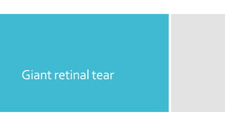 Giant retinal tear
 