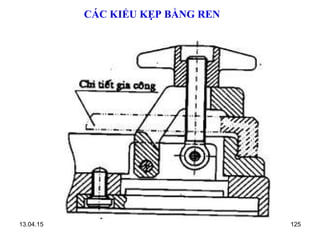 13.04.15 125
CÁC KIỂU KẸP BẰNG REN
 