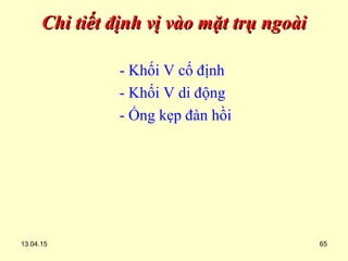 13.04.15 65
Chi tiết định vị vào mặt trụ ngoàiChi tiết định vị vào mặt trụ ngoài
- Khối V cố định
- Khối V di động
- Ống kẹp đàn hồi
 